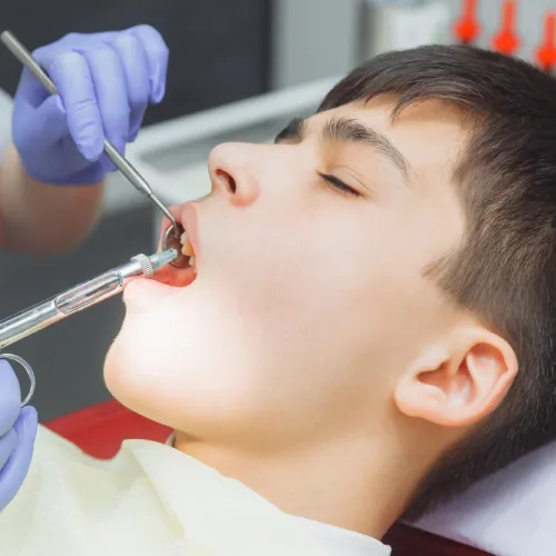 Friendly pediatric dentist in Oman placing dental filling for a child