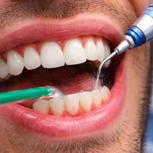 Ongoing Gum Maintenance