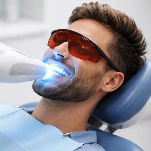 Professional Whitening at Al rabeeh -Al khoud