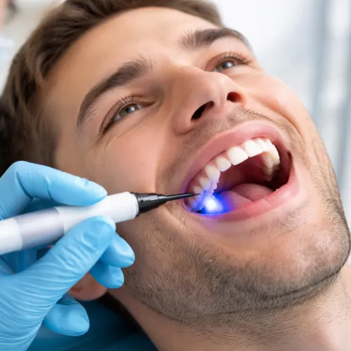 Sealing and Protection for teeth