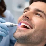 Painless Gum Recovery: The End of Scalpel Surgery